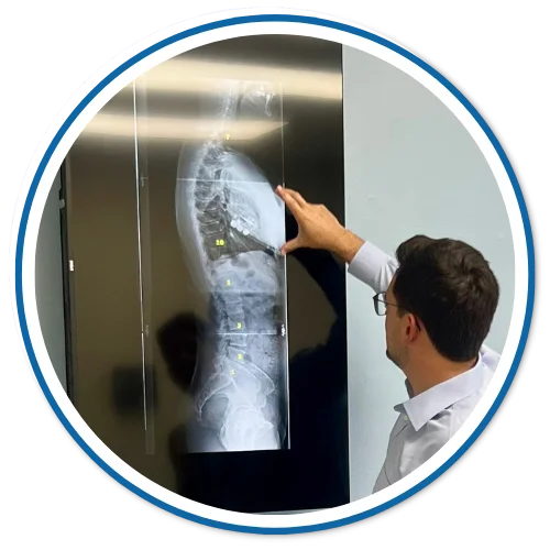 Gonstead X-rays in Pinecrest FL